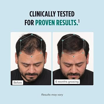 Nutrafol Men's Hair Growth Supplement, Clinically Proven for Thicker Hair and Improved Scalp Coverage, Dermatologist Recommended - 1-Month Supply for Trreatment